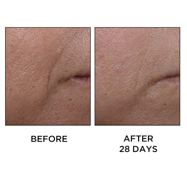 Perricone MD Cold Plasma Plus+ Face 30ml - Sérum Facial Antiedad Avanzado