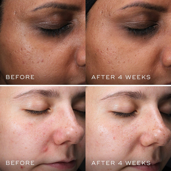 Medik8 Clarity PEPTIDES™ 30 ml
