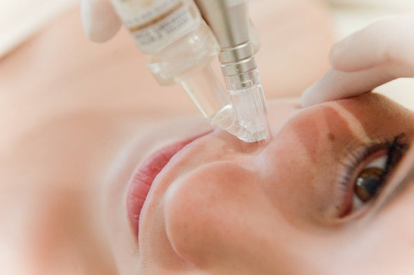 Tratamiento Vitaminas  Facial con micro inyecciones